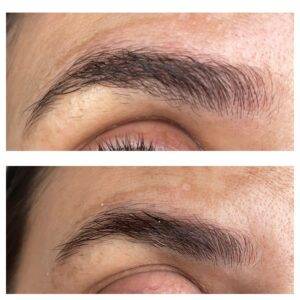 The Ordinary Brow Serum Before & After