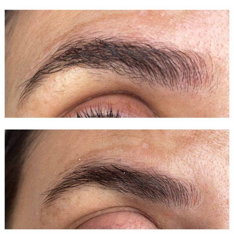 The Ordinary Lash & Brow Serum Reviews & Before & After Photo