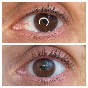 The Ordinary Lash & Brow Serum Before & After
