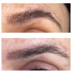 The Ordinary Brow Serum Before & After